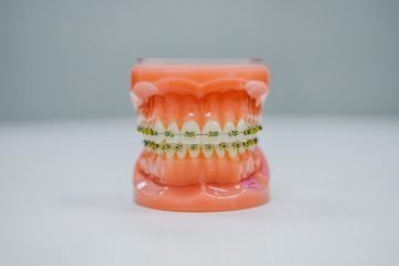 Când este indicat un tratament ortodontic cu aparat dentar?