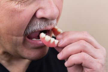 Cu ce poate fi inlocuita proteza dentara la pacientii cu edentatie totala?