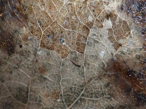 varicose veins